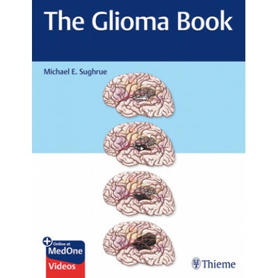 Glioma Book
