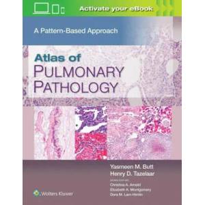 Atlas of Pulmonary Pathology | Jennifer Wer (ISBN: 9781496397553)