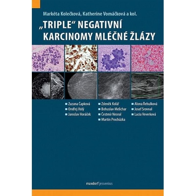 Triple“ negativní karcinomy mléčné žlázy