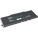 Avacom NODE-5410-68P batéria - neoriginálna