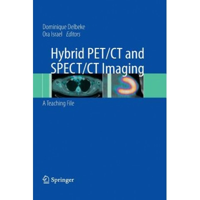 Hybrid PET/CT and SPECT/CT Imaging