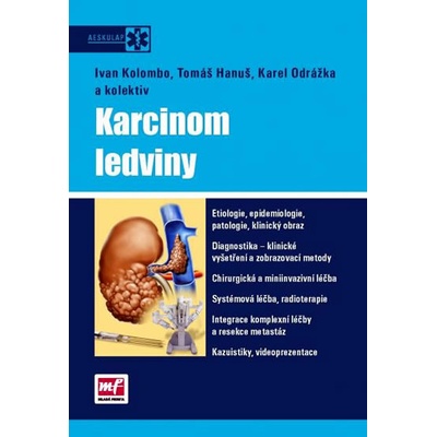 Karcinom ledviny + DVD - Ivan Kolombo