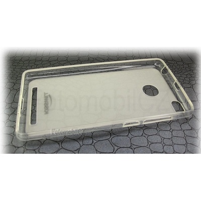 Kisswill TPU Pouzdro Xiaomi Redmi 3 Pro čiré