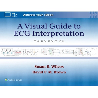 A Visual Guide to ECG Interpretation - Wilcox Susan Renee