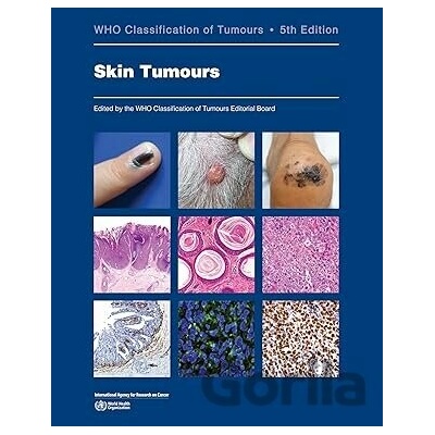 WHO Classification of Skin Tumours - IARC