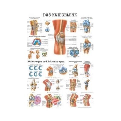 Rüdiger-Anatomie Naučný plakát Kolenní kloub