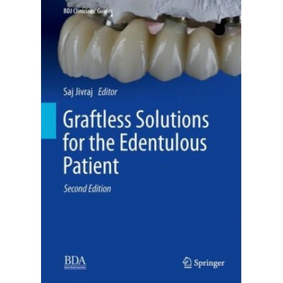Graftless Solutions for the Edentulous Patient