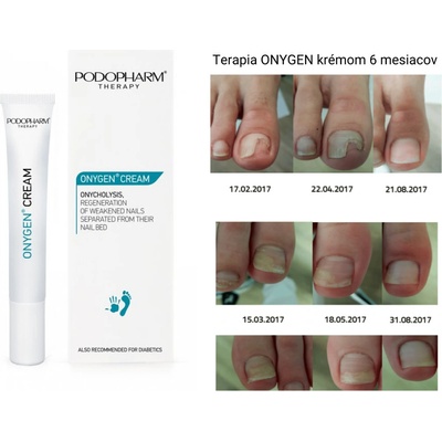 Podopharm Onygen Krém na nechty 20 ml