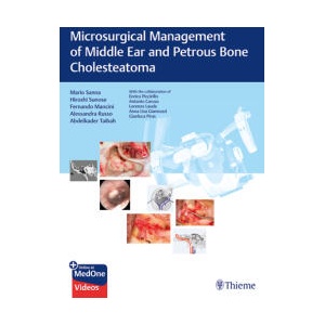 Microsurgical Management of Middle Ear and Petrous Bone Cholesteatoma | Mario Sanna, Hiroshi Sunose, Fernando Mancini, Alessandra Russo, Abdelkader Taibah (ISBN: 9783132000056)
