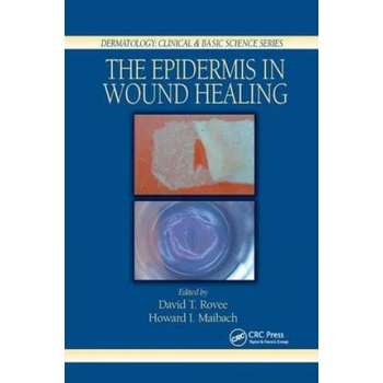 Image 1 of Epidermis in Wound Healing