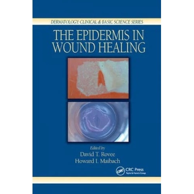 Epidermis in Wound Healing