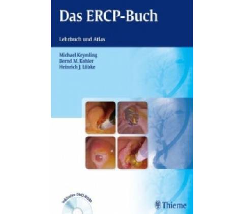 Das ERCP-Buch, m. DVD-ROM