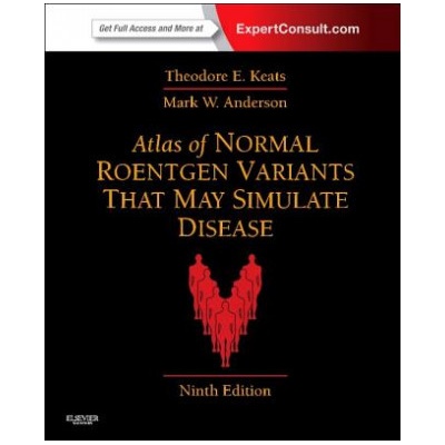 Atlas of Normal Roentgen Variants That May Simulate Disease