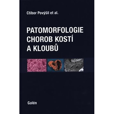 Patomorfologie chorob kostí a kloubů