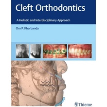 Cleft Orthodontics