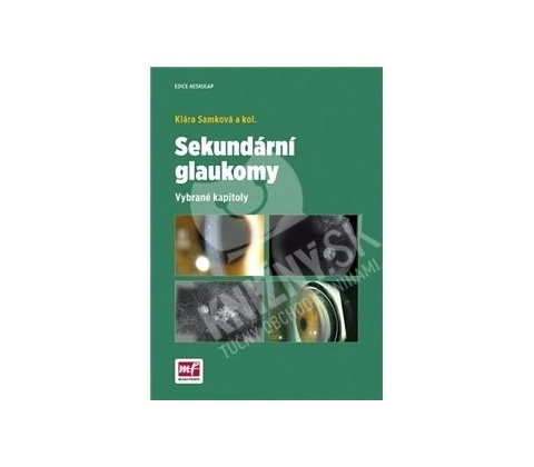 Sekundární glaukomy