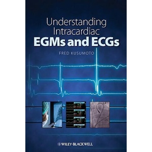 Understanding Intracardiac EGMs and ECGs | Fred Kusumoto (ISBN: 9781405184106)