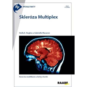 Skleróza Multiplex