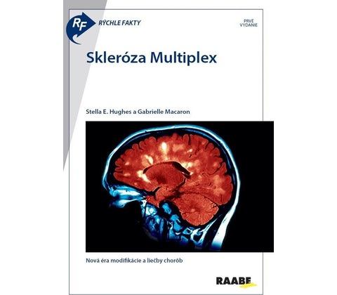 Skleróza Multiplex