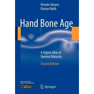 Hand Bone Age | Osman Ratib (ISBN: 9783642237614)