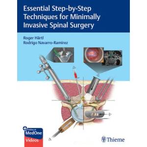 Essential Step-by-Step Techniques for Minimally Invasive Spinal Surgery | Rodrigo Navarro-Ramirez (ISBN: 9781684200092)