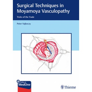 Surgical Techniques in Moyamoya Vasculopathy | Peter Vajkoczy (ISBN: 9783131450616)