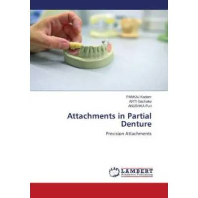 Attachments in Partial Denture | Arti Gachake, Anushka Puri