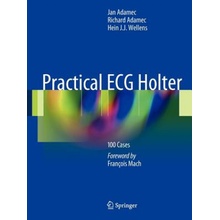 Practical ECG Holter