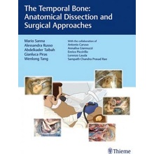 Temporal Bone