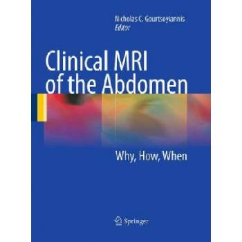Clinical MRI of the Abdomen | Nicholas C. Gourtsoyiannis