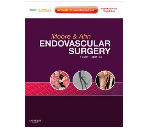 Endovascular Surgery, 4th Edition