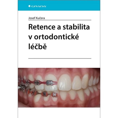 Retence a stabilita v ortodontické léčbě - Josef Kučera