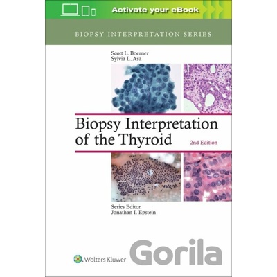 Biopsy Interpretation of the Thyroid Boerner Scott L.