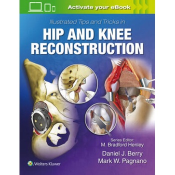 Image 1 of Illustrated Tips and Tricks in Hip and Knee Reconstructive and Replacement Surgery | Daniel J. Berry, Mark W. Pagnano