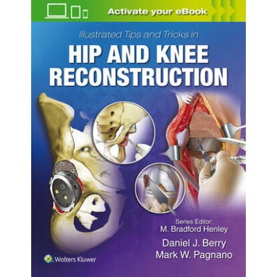 Illustrated Tips and Tricks in Hip and Knee Reconstructive and Replacement Surgery | Daniel J. Berry, Mark W. Pagnano