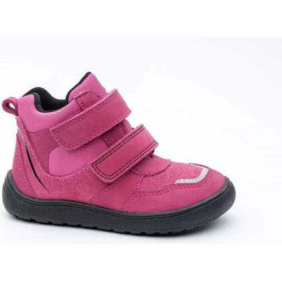 Protetika Banet s membránou fuxia