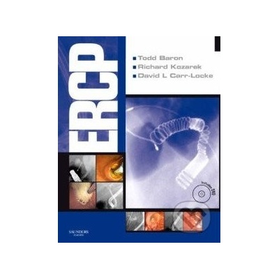 ERCP Expert Consult - Todd Baron