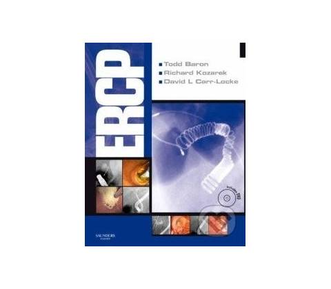 ERCP Expert Consult - Todd Baron