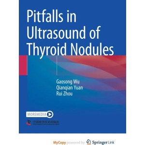 Pitfalls in Ultrasound of Thyroid Nodules (2023)
