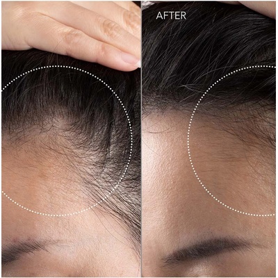 FOREO Led масажор за скалп за укрепване на косата FOREO FAQ 301 Blue Emerald (F0273)