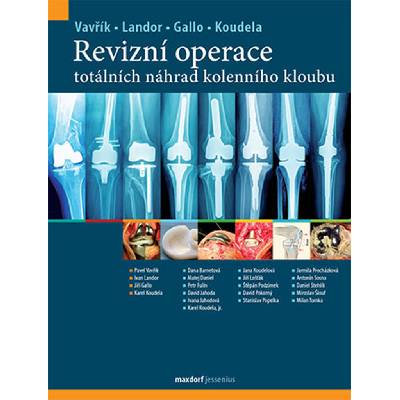 Revizní operace totálních náhrad kolenního kloubu - Karel Koudela, Pavel Vavřík, Jiří Gallo, Ivan Landor