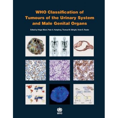 WHO Classification of Tumours of the Urinary System and Male Genital Organs - Holger Moch a kol.