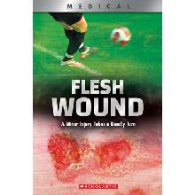 Flesh Wound (Xbooks): A Minor Injury Takes a Deadly Turn - Phillips Shea
