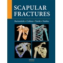 Scapular fractures