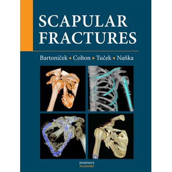 Scapular fractures