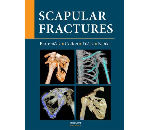 Scapular fractures