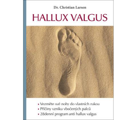 Hallux valgus