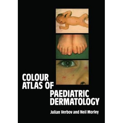 Colour Atlas of Paediatric Dermatology Verbov Julian
