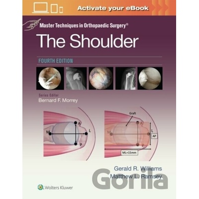 Master Techniques in Orthopaedic Surgery: The Shoulder - Gerald R. Williams Jr., Matthew L. Ramsey