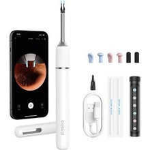 Smart Visual Ear-Clean Rod Bebird Note 5